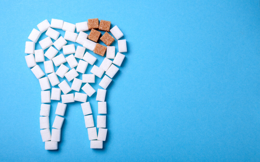 Les risques de la consommation excessive de sucre pour les dents