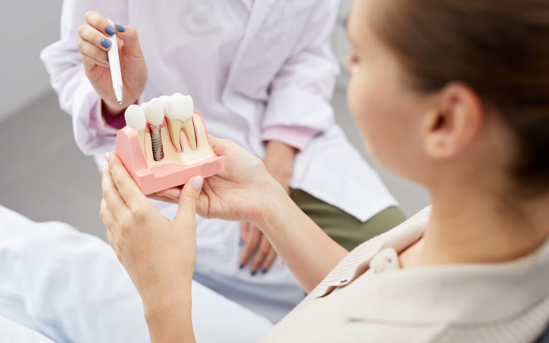 Implant et prothèse dentaire : quelles différences ?